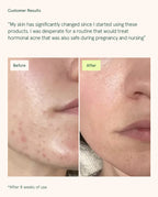 Core Four (Retinoid Alternative)