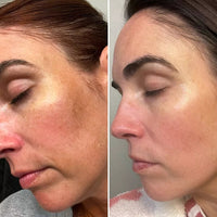 Thumbnail for Honestly Amazed