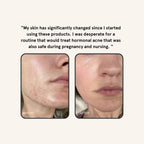 Core Four (Retinoid Alternative)