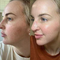 Thumbnail for My skin is glowing!