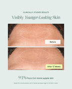 RetinAL Skin