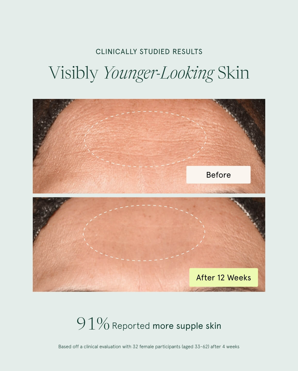 RetinAL Skin